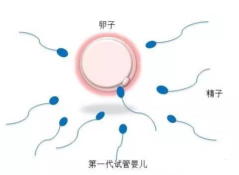 女人代怀试管